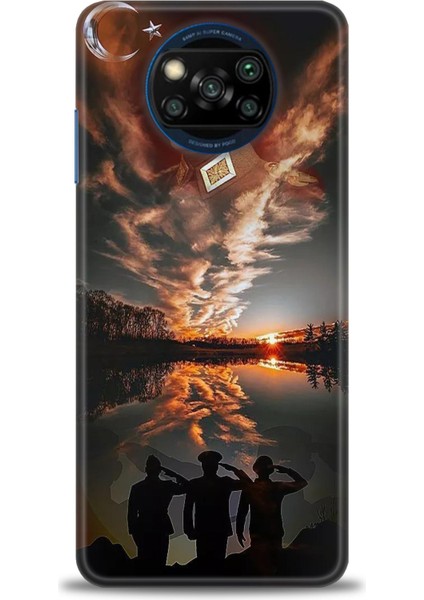 Xiaomi Poco X3 Pro Kılıf Hd Baskılı Kılıf + Seramik Tam Kaplayan Ekran Koruyucu 26