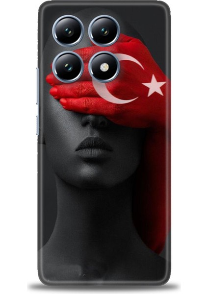 Xiaomi Mi 14T Pro Kılıf Hd Baskılı Kılıf + Seramik Tam Kaplayan Ekran Koruyucu 246