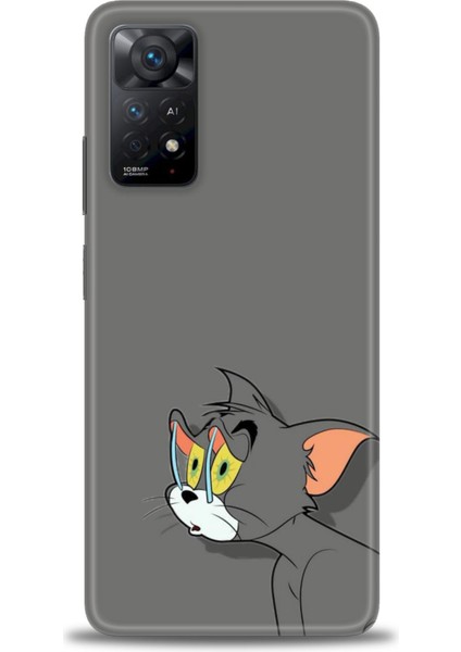 Xiaomi Redmi Note 11 Pro 4g Hd Baskılı Kılıf + Seramik Tam Kaplayan Ekran Koruyucu 408