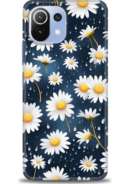 Xiaomi Mi 11 Lite Kılıf Hd Baskılı Kılıf + Seramik Tam Kaplayan Ekran Koruyucu 132
