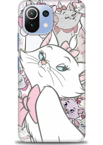 Xiaomi Mi 11 Lite Kılıf Hd Baskılı Kılıf + Seramik Tam Kaplayan Ekran Koruyucu 216