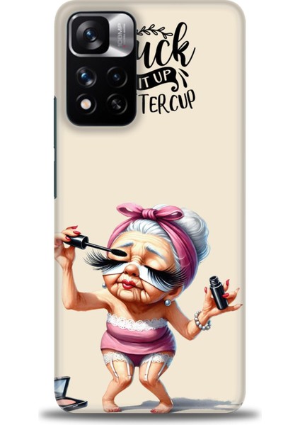 Xiaomi Redmi Note 11 Pro Plus Hd Baskılı Kılıf + Seramik Tam Kaplayan Ekran Koruyucu 50