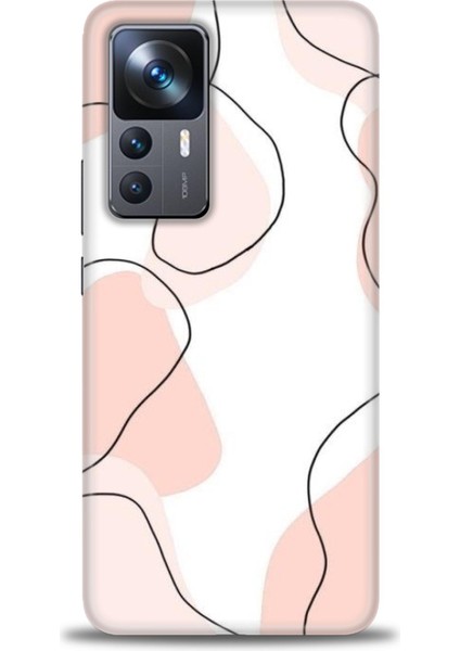 Xiaomi Mi 12T Pro Kılıf Hd Baskılı Kılıf + Seramik Tam Kaplayan Ekran Koruyucu 180