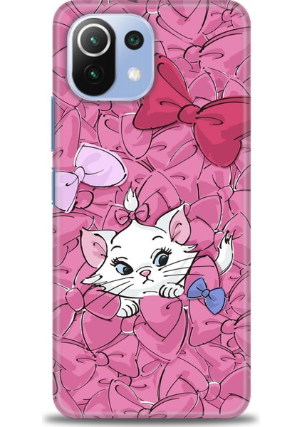 Xiaomi Mi 11 Lite Kılıf Hd Baskılı Kılıf + Seramik Tam Kaplayan Ekran Koruyucu 215