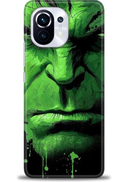 Xiaomi Mi 11 Kılıf Hd Baskılı Kılıf + Seramik Tam Kaplayan Ekran Koruyucu 94