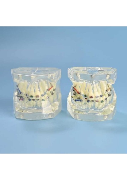 Dental Çıkarılabilir Şeffaf Birincil Modeli Çalışması Dökme Ortodonti Şeffaf Metal Braket Ligatür Bağı Diş Modeli