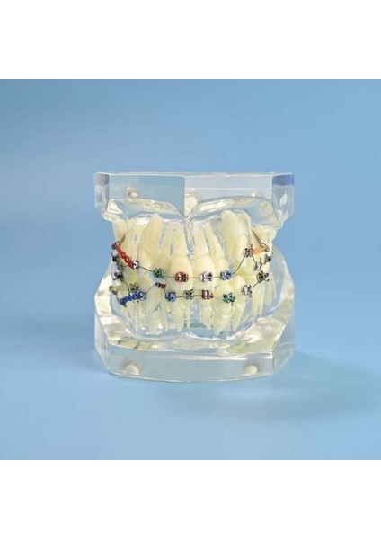 Dental Çıkarılabilir Şeffaf Birincil Modeli Çalışması Dökme Ortodonti Şeffaf Metal Braket Ligatür Bağı Diş Modeli