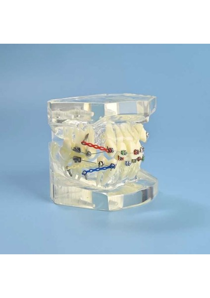Dental Çıkarılabilir Şeffaf Birincil Modeli Çalışması Dökme Ortodonti Şeffaf Metal Braket Ligatür Bağı Diş Modeli