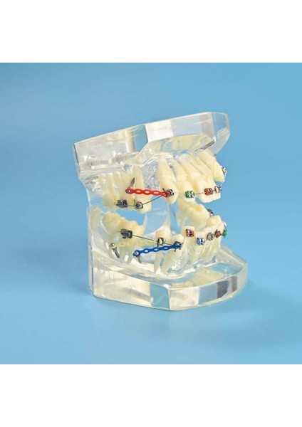 Dental Çıkarılabilir Şeffaf Birincil Modeli Çalışması Dökme Ortodonti Şeffaf Metal Braket Ligatür Bağı Diş Modeli