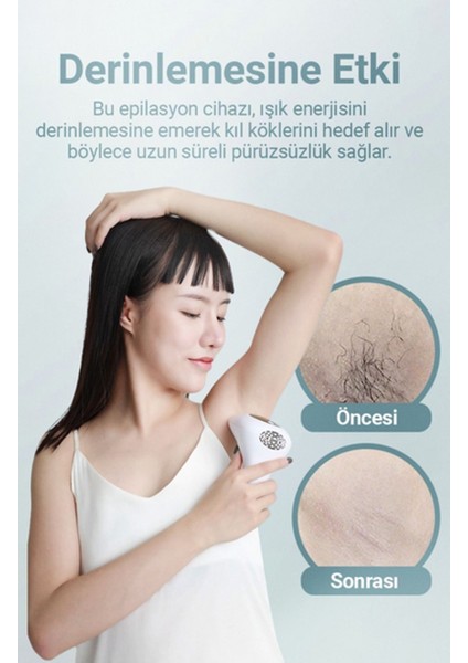Tüm Vücut ve Yüz Için Ipl Buz LAZER-900.00 Atım-8 Aşamalı Güç Kablolu Lazer Epilasyon