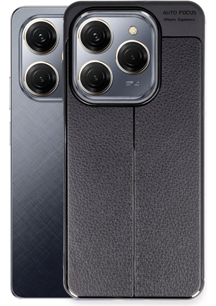 Tecno Spark 20 Pro Kılıf Auto Focus Kapak - Siyah Bstmy