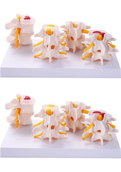 Insan Anatomisi 4- Lomber Vertebral Model Öğretim Malzemeleri (Yurt Dışından)
