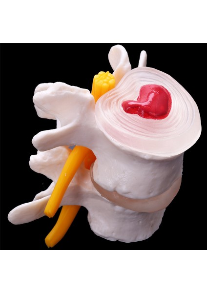 Insan Anatomisi 4- Lomber Vertebral Model Öğretim Malzemeleri (Yurt Dışından)