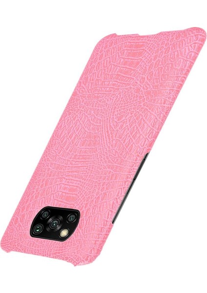 Şık Klasik Durumda Xiaomi Poco X3 Nfc Klasik Timsah Moda Anti (Yurt Dışından)