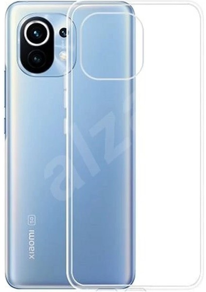 Xiaomi Mi 11 Kılıf Lüx Şeffaf Silikon Bstmy