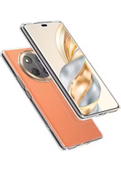 Honor Magic 7 Lite Uyumlu Kılıf Silikon Şeffaf + Ekran Koruyucu Ped