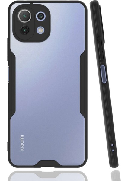 Xiaomi Mi 11 Lite Kılıf Platin Silikon - Siyah Bstmy
