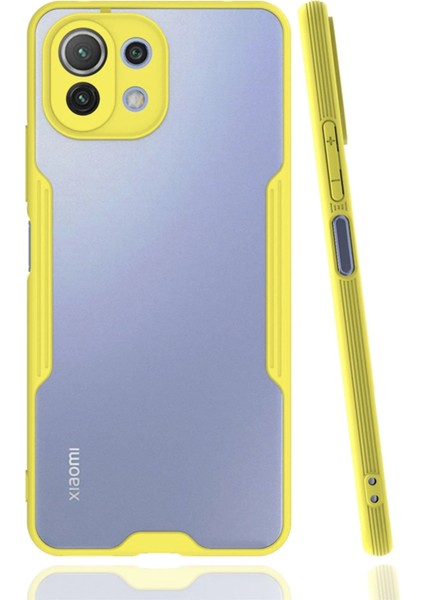 Xiaomi Mi 11 Lite Kılıf Platin Silikon - Sarı Bstmy