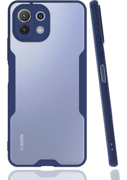Xiaomi Mi 11 Lite Kılıf Platin Silikon - Lacivert Bstmy