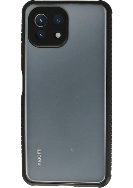Xiaomi Mi 11 Lite Kılıf Miami Şeffaf Silikon - Siyah Bstmy
