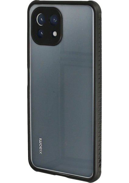 Xiaomi Mi 11 Lite Kılıf Miami Şeffaf Silikon - Siyah Bstmy