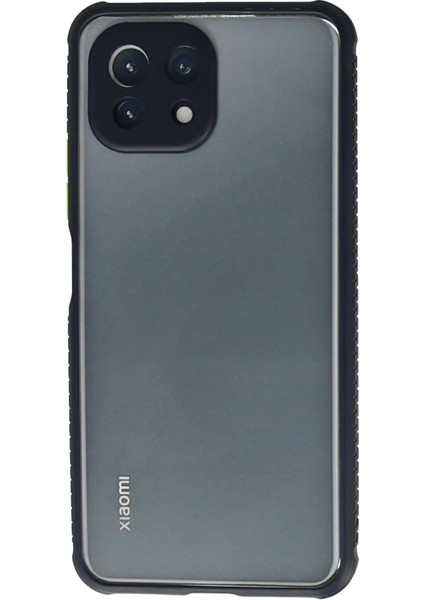 Xiaomi Mi 11 Lite Kılıf Miami Şeffaf Silikon - Lacivert Bstmy
