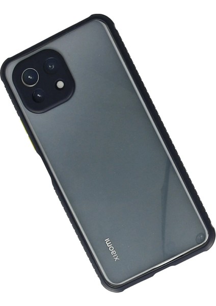 Xiaomi Mi 11 Lite Kılıf Miami Şeffaf Silikon - Lacivert Bstmy