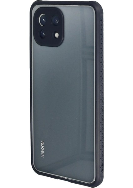 Xiaomi Mi 11 Lite Kılıf Miami Şeffaf Silikon - Lacivert Bstmy