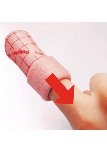 4401 - Polymem Finger #1 (Small) Parmak Örtü
