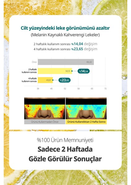 Leke Karşıtı Serum Yaprak Maske Goodal Green Tangerine Vita C Dark Spot Care Serum Sheet Mask
