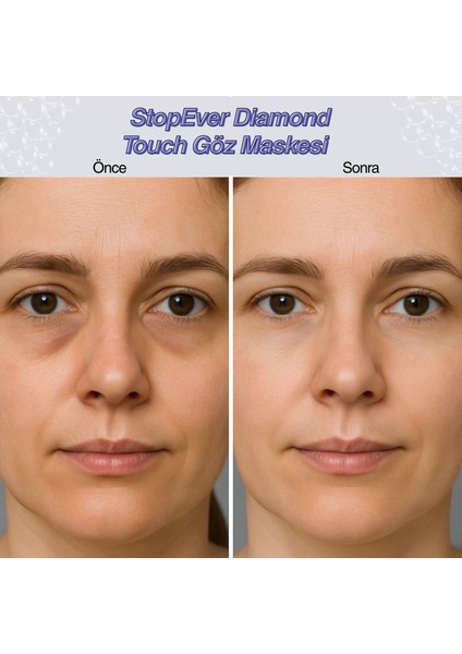 Diamond Touch Soft - Göz Maskesi -2 Adet