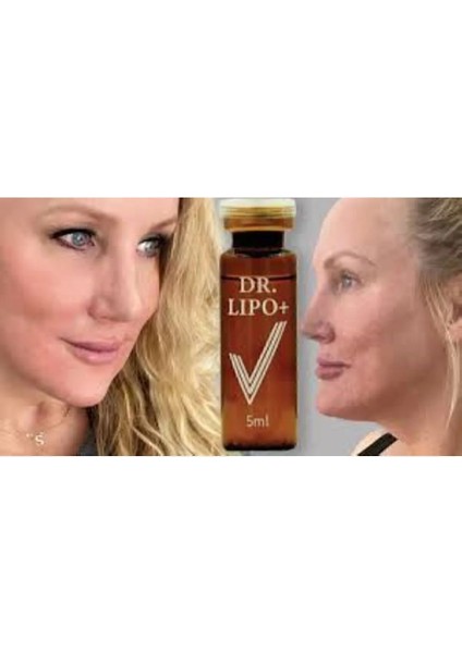 Dr Lipo Mezoterapi Gıdı Eritme, Yanak Inceltme [1 Flakon 5ml Fiyatıdır]