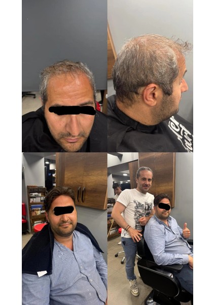 Protez Saç New Ancora 6X10 Koyu Kahve,ınce Telli Her Yöne Taranabilen Alt Yapı %100 Insan Saçı fiyatları