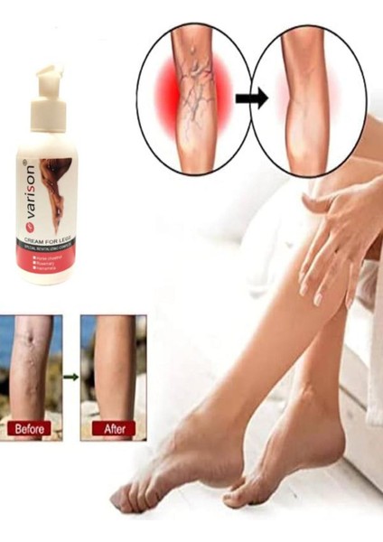 Varison Vari.s Sellülit Bacak Bakım Kremi 120 ml