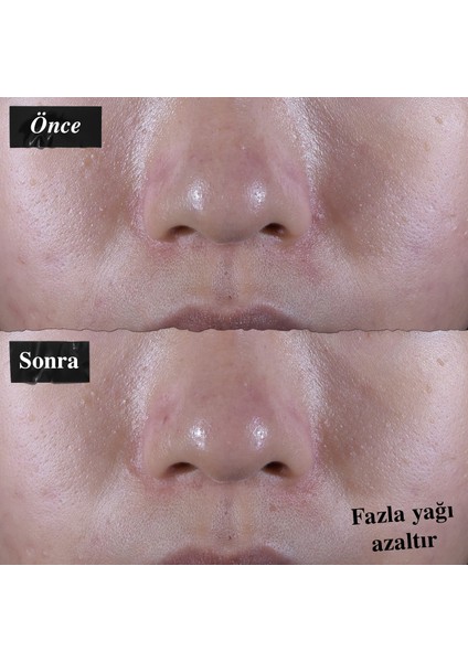 Ultra Facial Oil-Free Yağlı Ciltler Için 24 Saat Nemlendiren Gözenek Karşıtı Jel Krem 150 ml