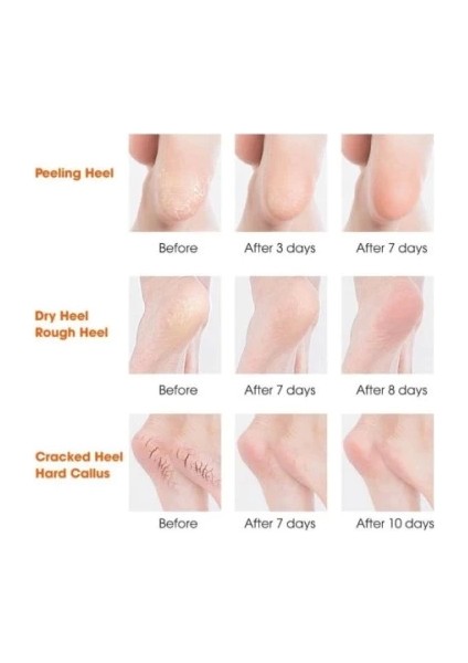 Silikon Topuk Nemlendirici Çorap fırsatları