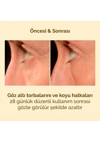 ceutics K-Ox Eyes 15 G