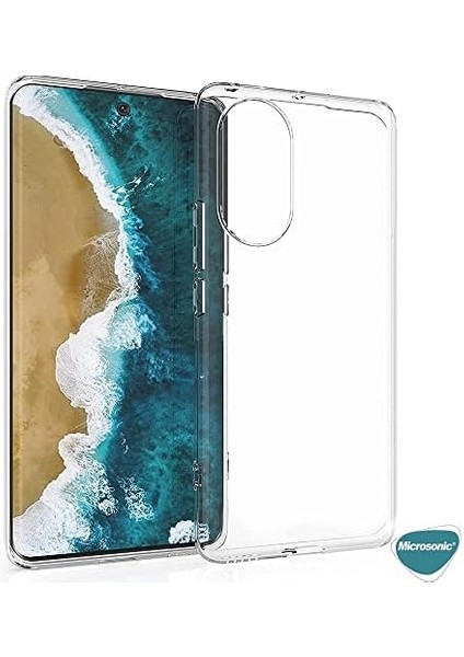 Huawei Nova 9 Için Kılıf Transparent Soft Beyaz [nova 9 ile Uyumlu Kılıf - Beyaz]