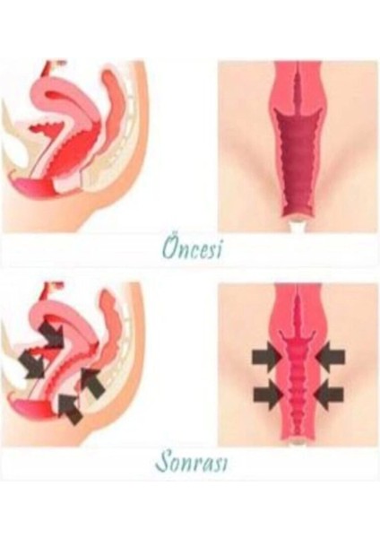 Kadınlar Için Genital Bölge Şekillendirici Krem 100 ml x 3 Adet