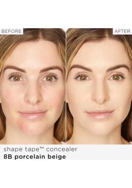 Shape Tape™ - Kapatıcı modelleri
