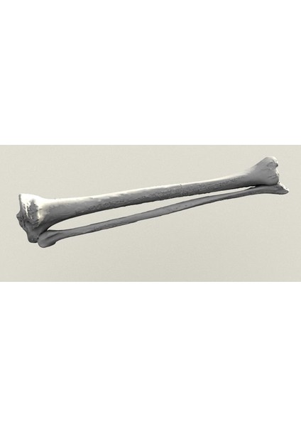 Insan Tibia ve Fibula (Plastik Aparattır!!!)