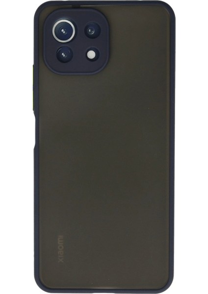 Xiaomi Mi 11 Lite Kılıf Montreal Silikon Kapak - Lacivert Dpmah