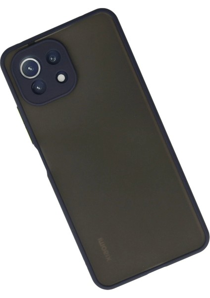 Xiaomi Mi 11 Lite Kılıf Montreal Silikon Kapak - Lacivert Dpmah