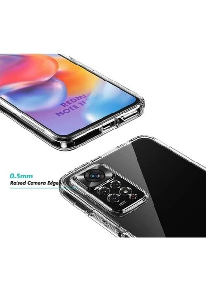 Xiaomi Redmi Note 11 Uyumlu Kılıf Ön Arka 360 Koruma Arka Sert Mika Ön Silikon Şeffaf