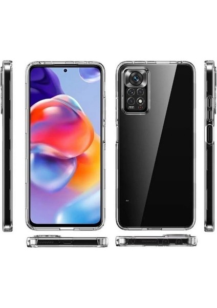 Xiaomi Redmi Note 11 Uyumlu Kılıf Ön Arka 360 Koruma Arka Sert Mika Ön Silikon Şeffaf