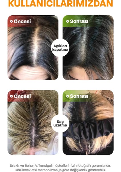 Biotin Complex Saç ve Tırnak Vitamini - Hair Vitamin B Complex Keratin Çinko 5000 Mg Biyotin Tablet Saç Dökülme Vitamin Mineral Takviyesi Folik Asit At Kuyruğu Ekstresi Magnezyum B7 B12 Vitamini S fırsatları