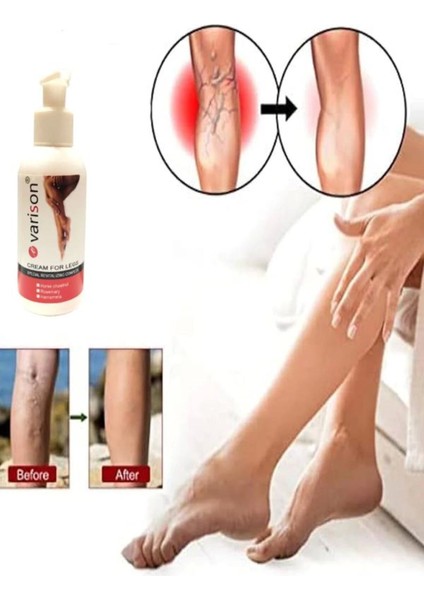 Varicose Vein Defense Var.is Bacak Bakım Kremi 120 ml x 1 Adet