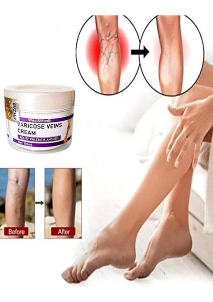 West & Month Varicose Vein Var.is Karşıtı Masaj Bakım Kremi 100 ml