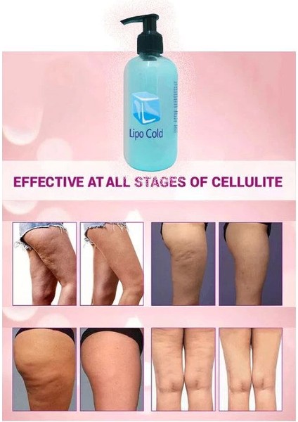 Lipo Cold Seliülitlerinize&fazlalıklarınıza Karşı Bakım Kremi 250 ml x 2 Adet