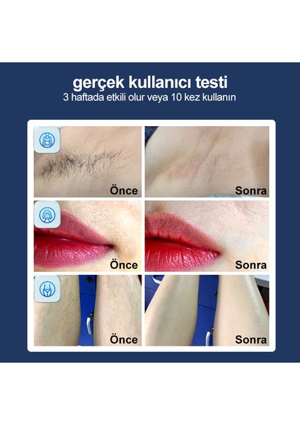 Lazer Epilasyon Cihazı 500.000 Atım 3 Başlık Vücut+Yüz+Özel Bölge Bay-Bayan Epilasyon Ultra Seri Atım Ipl Lazerler